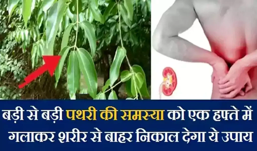 बड़ी से बड़ी पथरी की समस्या को एक हफ्ते में गलाकर शरीर से बाहर निकाल देगा ये चमत्कारी उपाय, शेयर जरूर करें बड़ी से बड़ी पथरी की समस्या को एक हफ्ते में गलाकर शरीर से बाहर निकाल देगा ये चमत्कारी उपाय, शेयर जरूर करें
