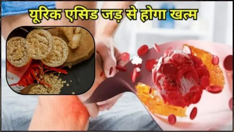 खून और जोड़ों में जमा सारा यूरिक एसिड बाहर निकल देगी 5 रुपये की ये चीज गठिया से भी मिल जाएगा छुटकारा खून और जोड़ों में जमा सारा यूरिक एसिड बाहर निकल देगी 5 रुपये की ये चीज गठिया से भी मिल जाएगा छुटकारा