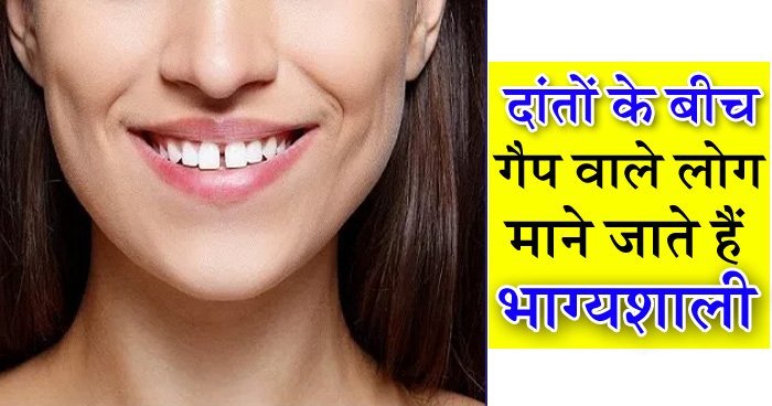 teeth-gap-09.06.19-2