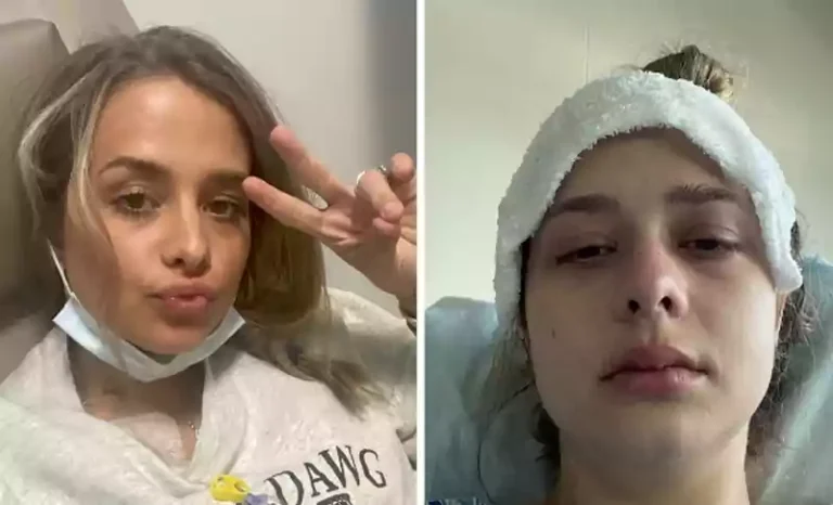 सालों से महिला को आ रही थी डकार