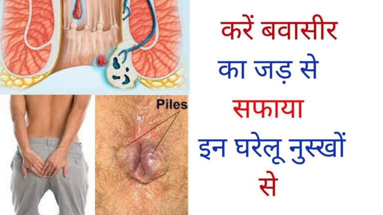 453d23467dec286c62ac5c06ed977a02