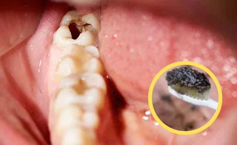 Homemade Toothpaste For Cavity