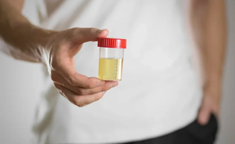 Protein Leakage in Urine
