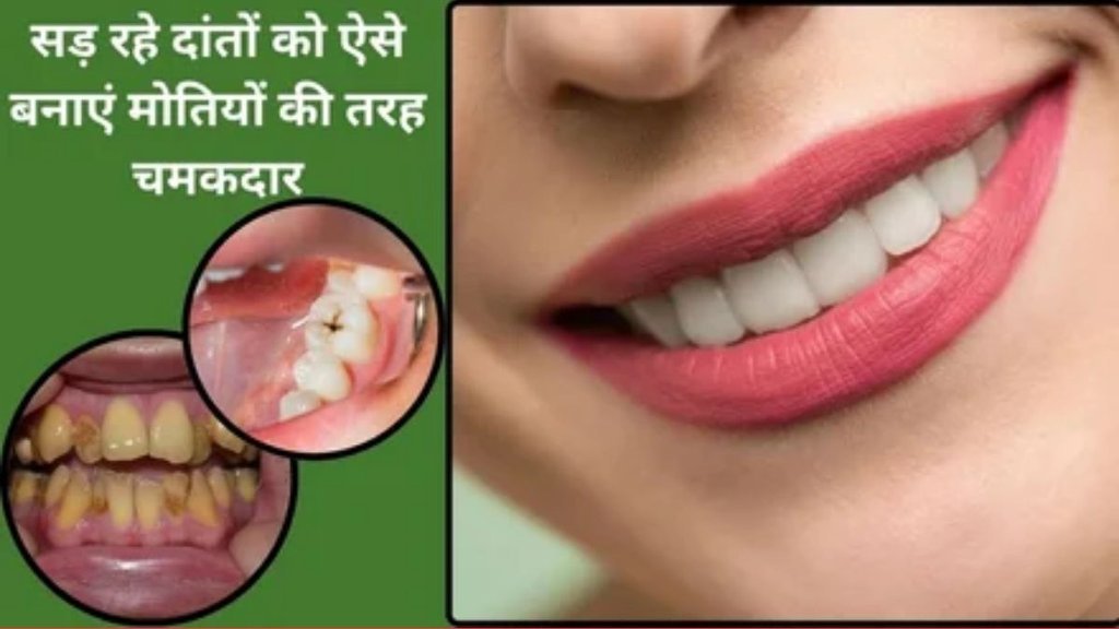 Remedies to remove yellow plaque from teeth, home remedies to whiten yellow teeth, remedies for teeth whitening, remedies to strengthen teeth and heart Remedies to remove yellow plaque from teeth, home remedies to whiten yellow teeth, remedies for teeth whitening, remedies to strengthen teeth and heart