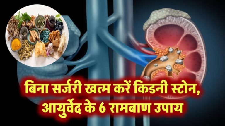 6-best-ayurvedic-home-remedies-to-dissolve-kidney-stones-naturally-1024x576