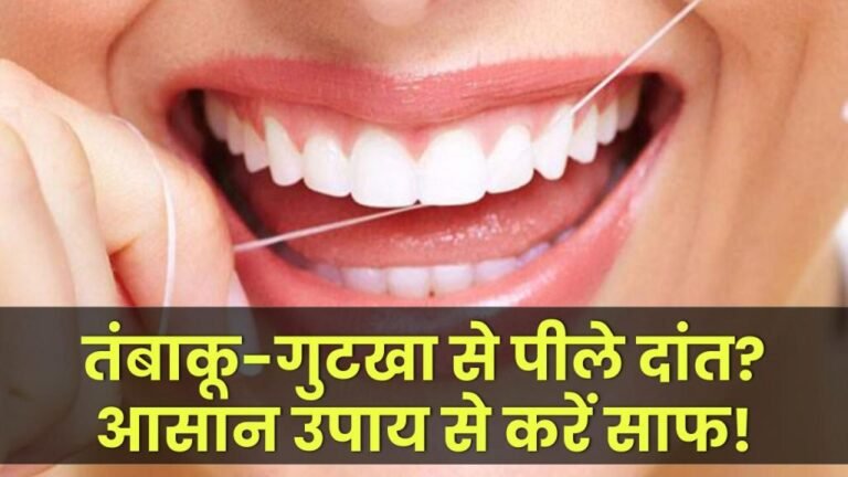 how-to-remove-tobacco-stains-from-teeth-know-detail
